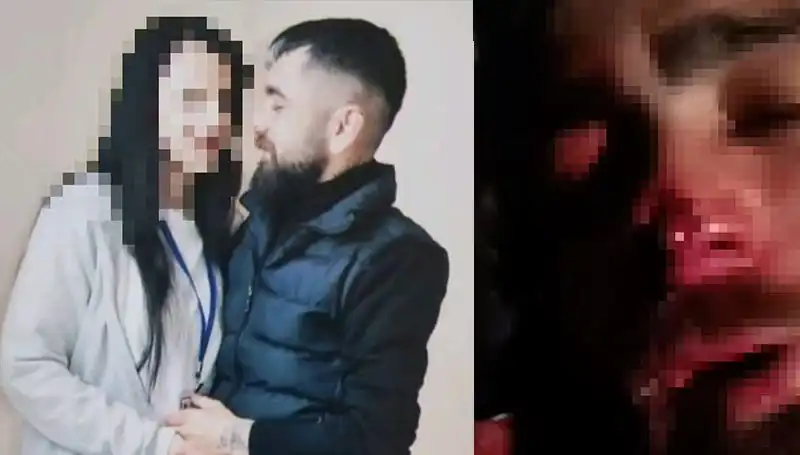 Eski Sevgiliye Nefret Dolu İntikam: Kulağı ve Burnu Coplandı!