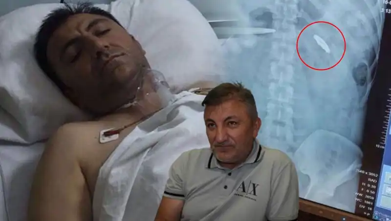 15 Temmuz’un Karanlık Yüzü: Vücudunda Kurşunla Yaşayan Kahramanlar