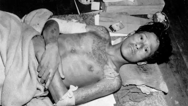 80 Yıl Sonra Nagasaki’den Yayınlanan Uyarı: Nükleer Felaket Tehdidi Giderek Artıyor!