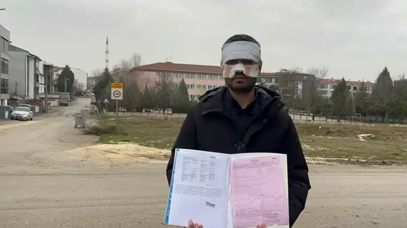 Öğretmenden Öğretmene Şok Edici Çay Saldırısı: Yüzde 2. Derece Yanık!